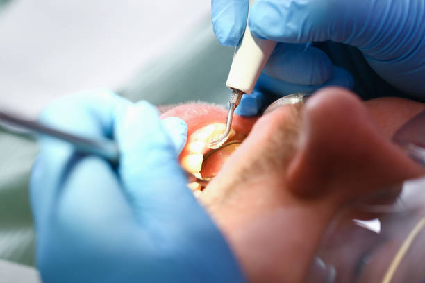 Best Holiday Emergency Dentist in Shelton, WA